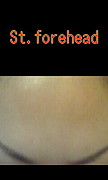 St.Forehead