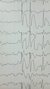 みんなの脳波(EEG)