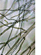 ���������ݻ��Τ��ȱ�UP����