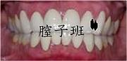 紻���