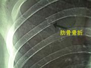 ��¼����
