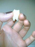 �Х��Х�ȴ�������