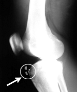 �������åɤ�Ǻ��ͤ�