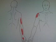 『トリガーポイント鍼治療日記』