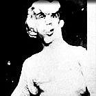 Joseph Carey Merrick