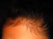 Baby Hair