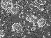 体性幹細胞による再生医療