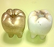 歯科技工士の妻たち