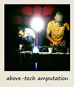 above-tech amputation