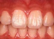 �����̤���̴�򸫤롣